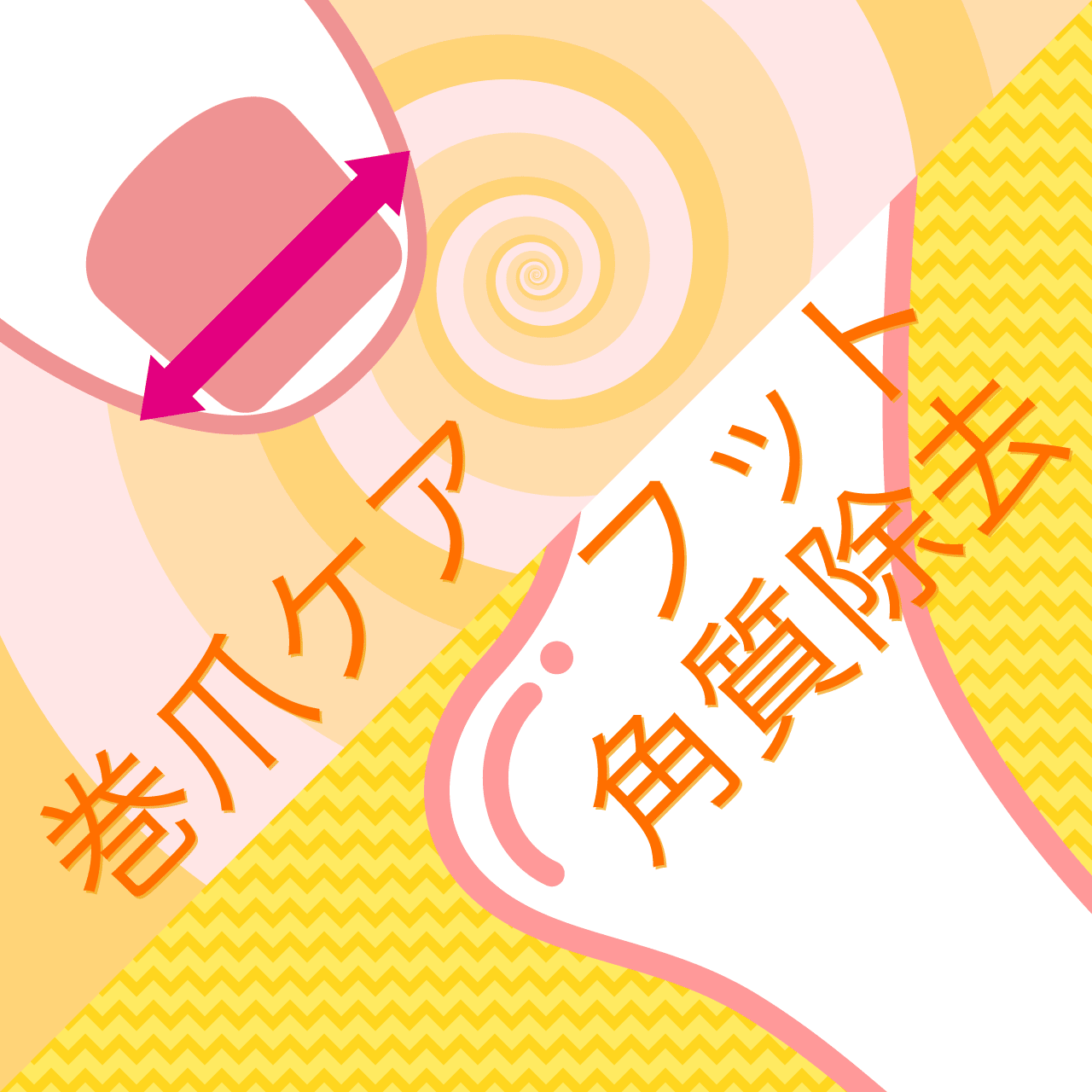 ご新規のお客様限定 ネイルサロンの角質除去&巻爪ケアご体感フェア
